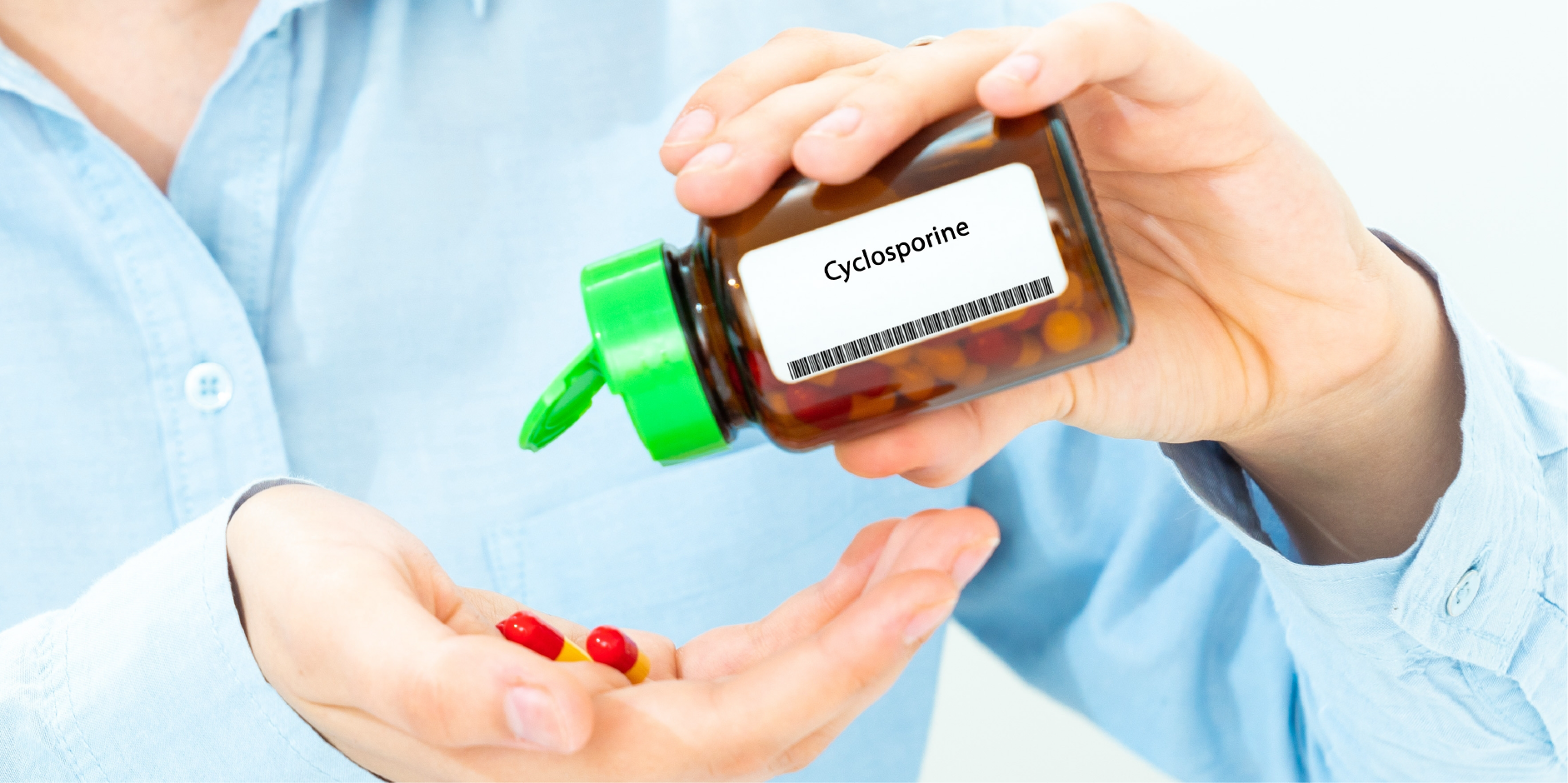 Inflammatory Bowel Disease_Management 9