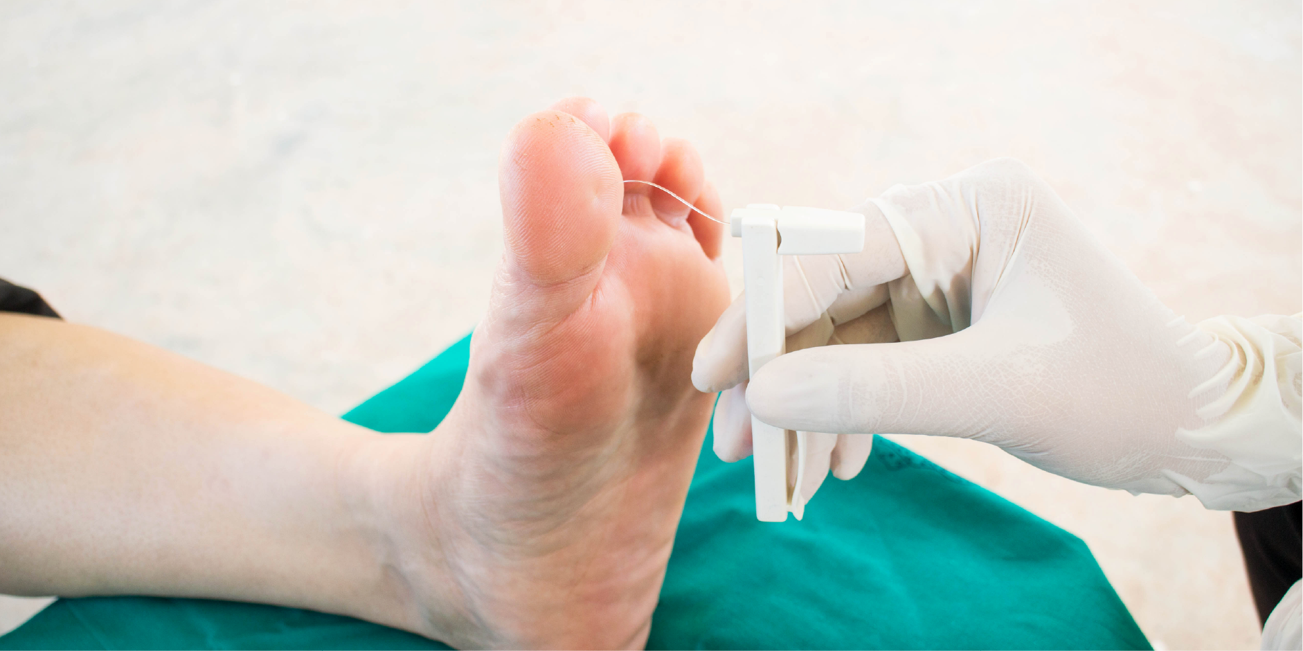 Diabetic Neuropathy_Initial Assesment 1