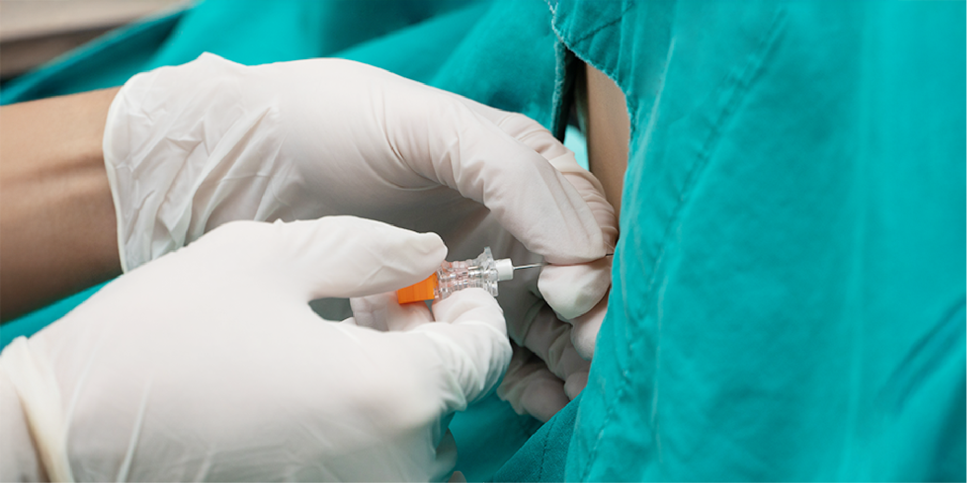 Chronic Lymphocytic Leukemia_Diagnostics 2