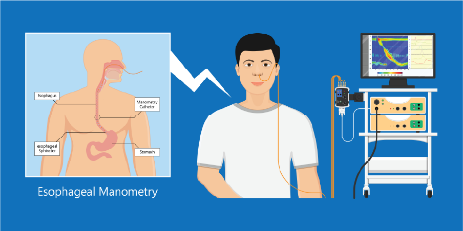 Gastroesophageal Reflux Disease_Diagnotics 2