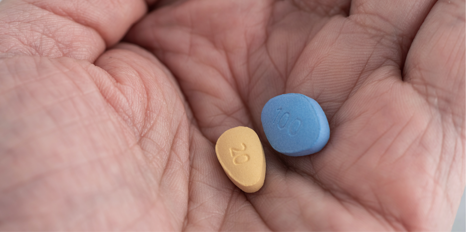 Erectile Dysfunction_Management 1