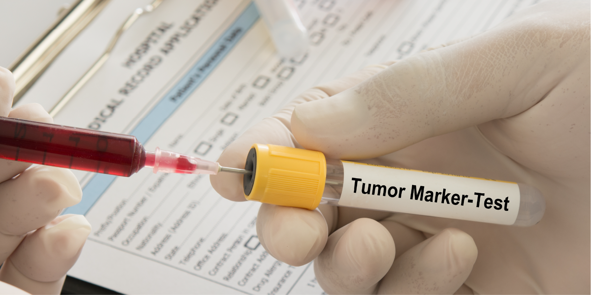 Endometrial Cancer_Diagnotics 1