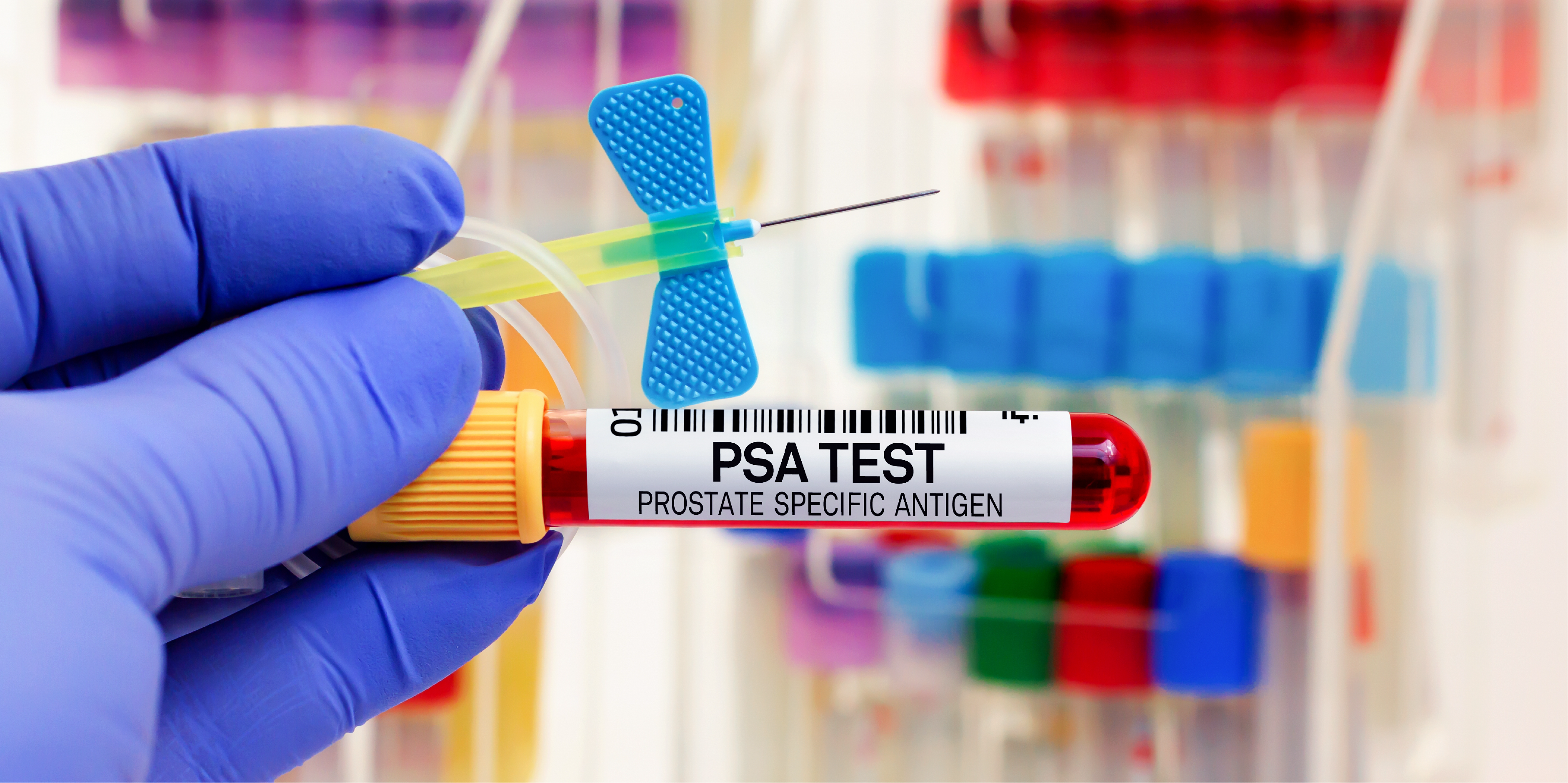 Prostate Cancer_Initial Assesment 2