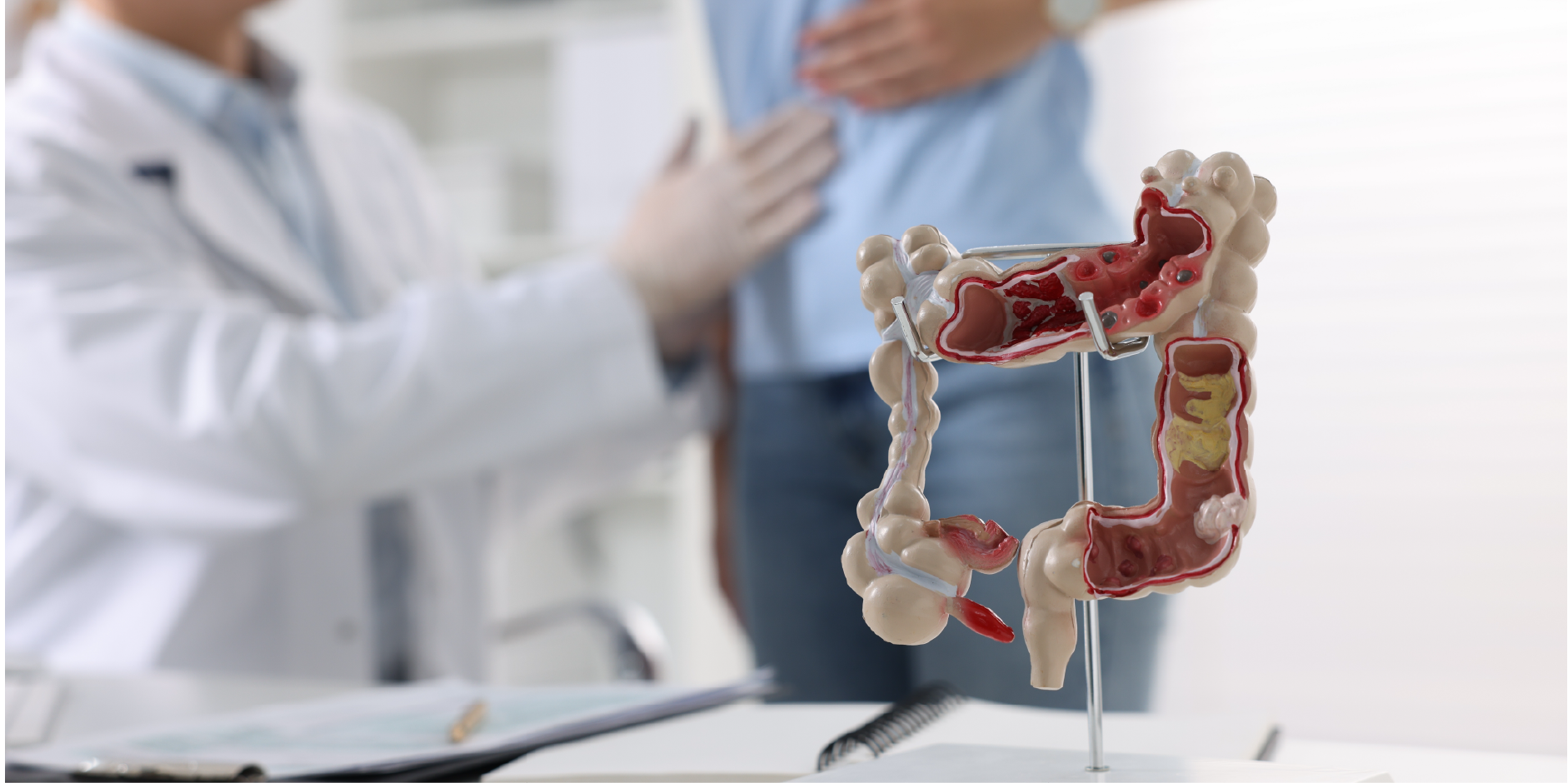 Inflammatory Bowel Disease_Management 17