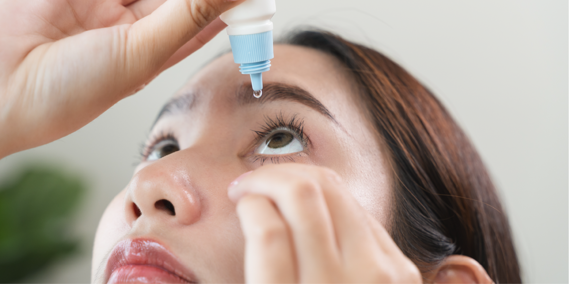 Dry Eye Syndrome_Management 1