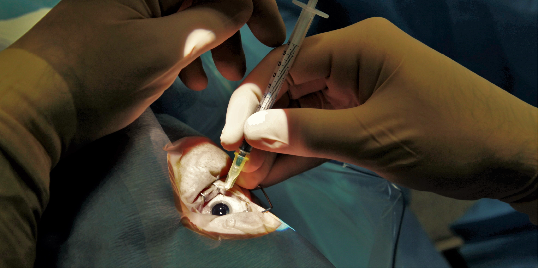 Diabetic Retinopathy_Management 1