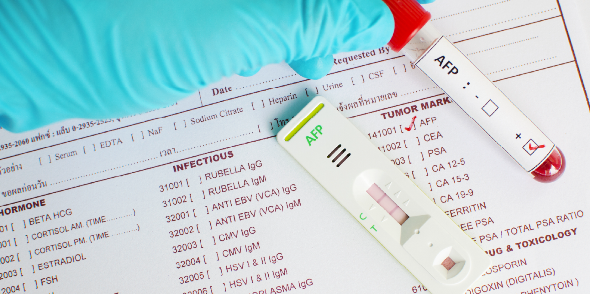 Hepatocellular Carcinoma Initial Assessment Mims Thailand