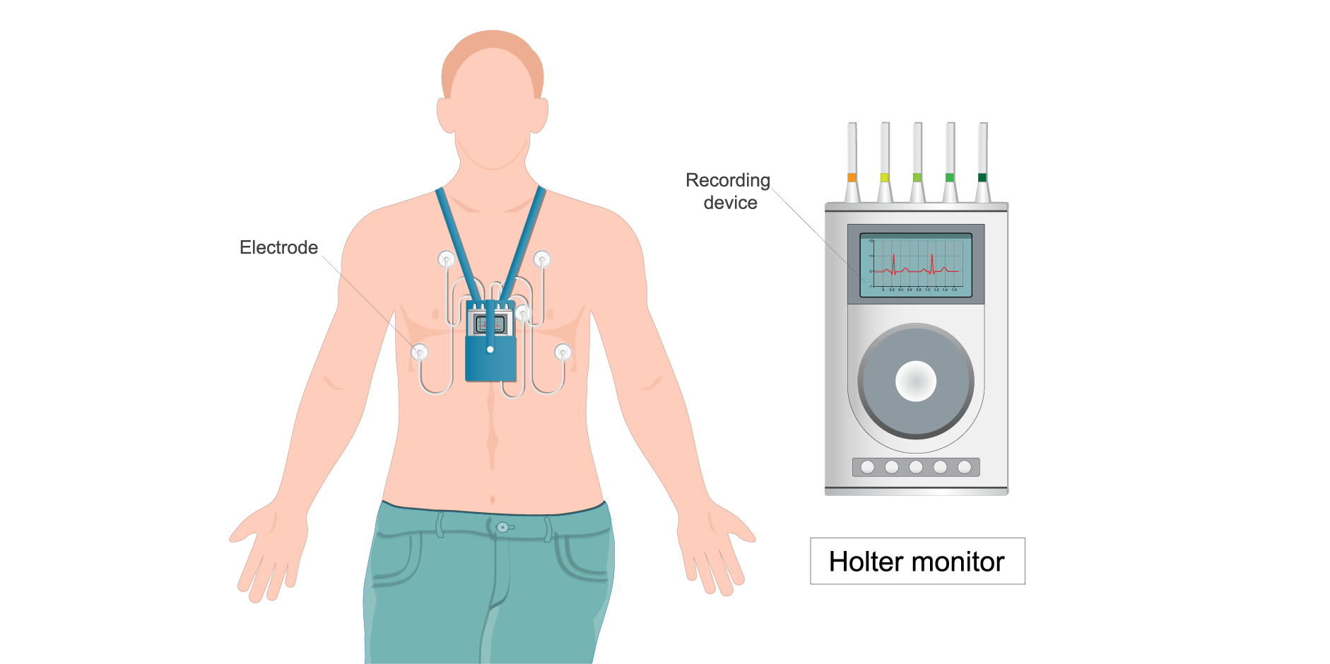 Chronic Coronary Syndromes_Diagnostics 3