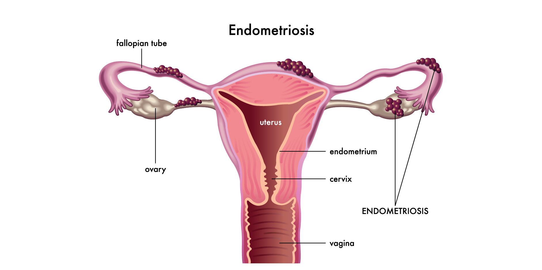 Infertility_Disease Background 2