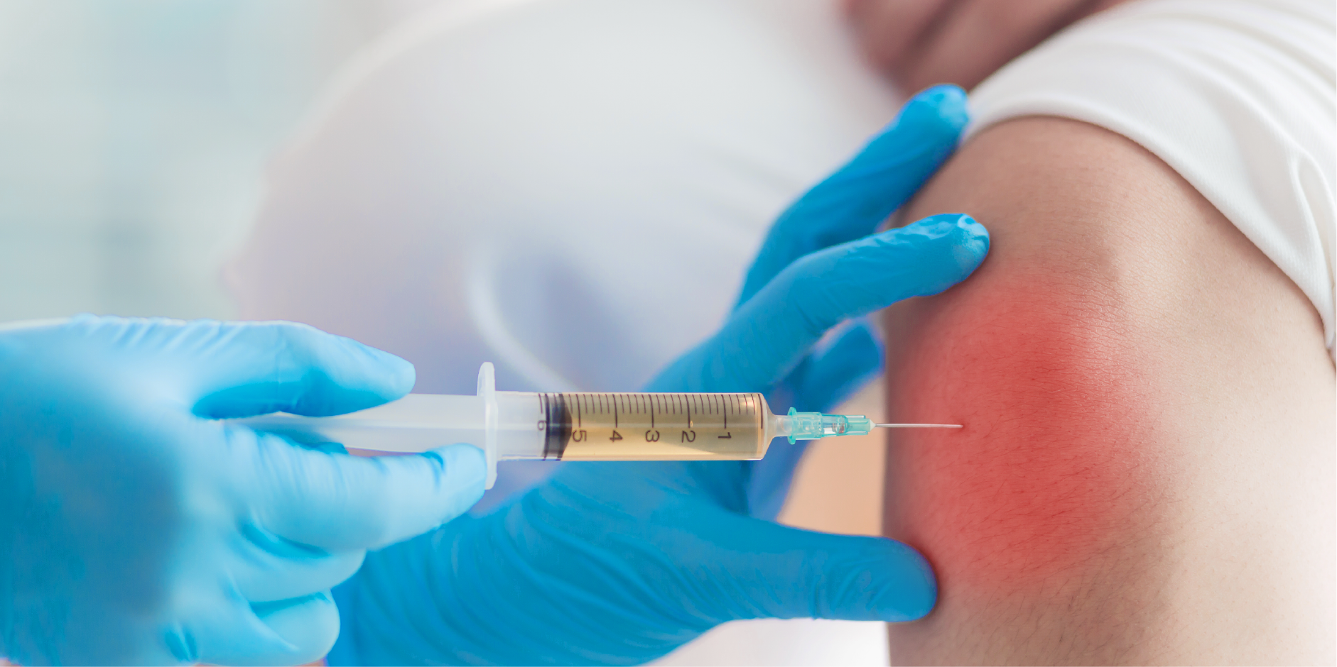 Infectious Arthritis_Diagnotics 1