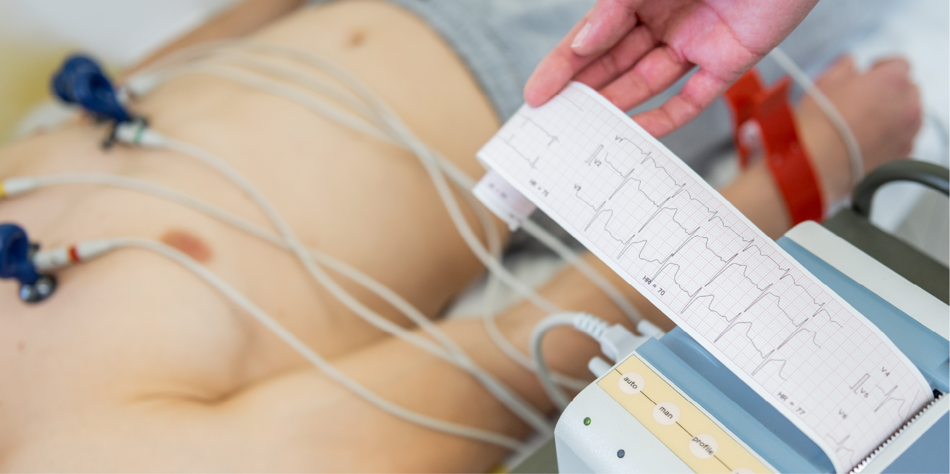 Chronic Coronary Syndromes_Diagnostics 1
