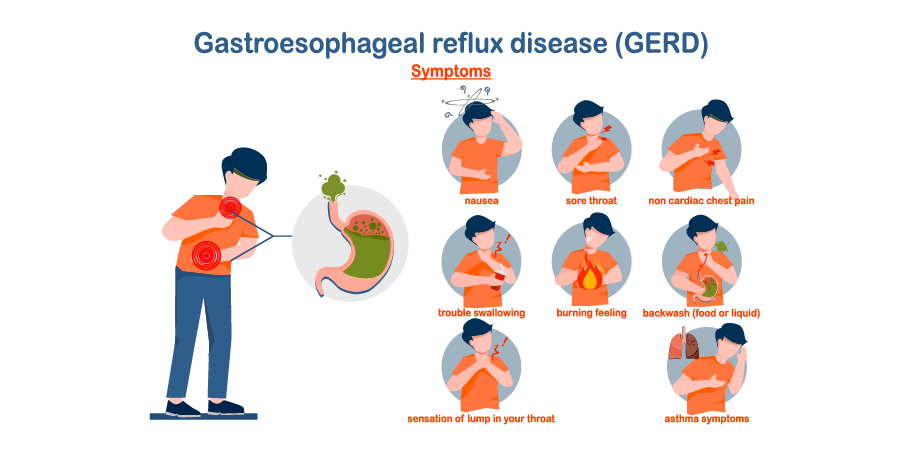 Gastroesophageal Reflux Disease_Initial Assesment