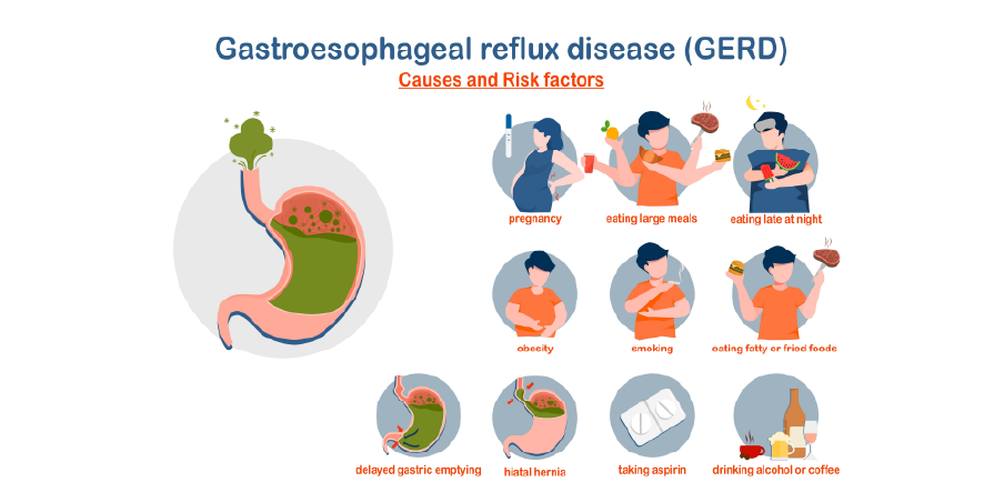 Gastroesophageal Reflux Disease_Disease Background 3