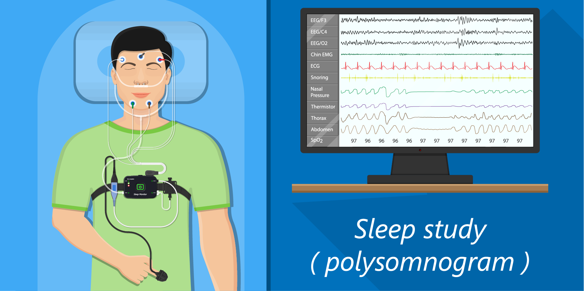 Insomnia_Diagnostics