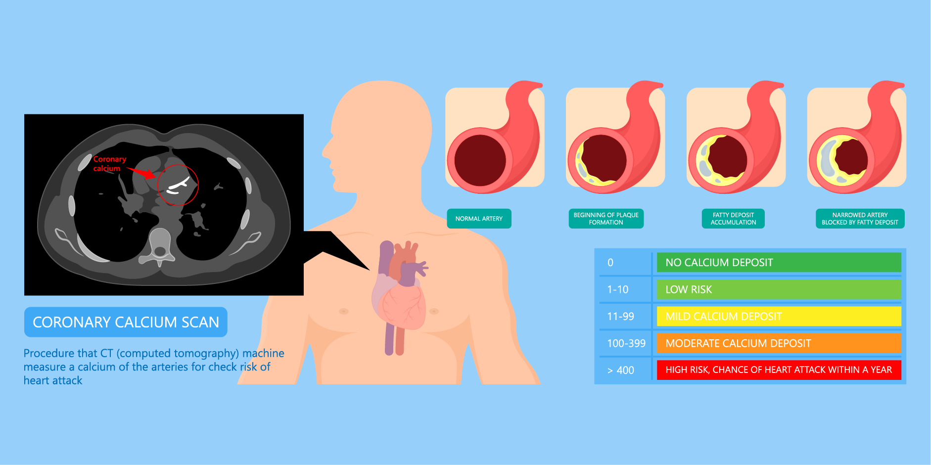 Chronic Coronary Syndromes_Initial Assesment 3