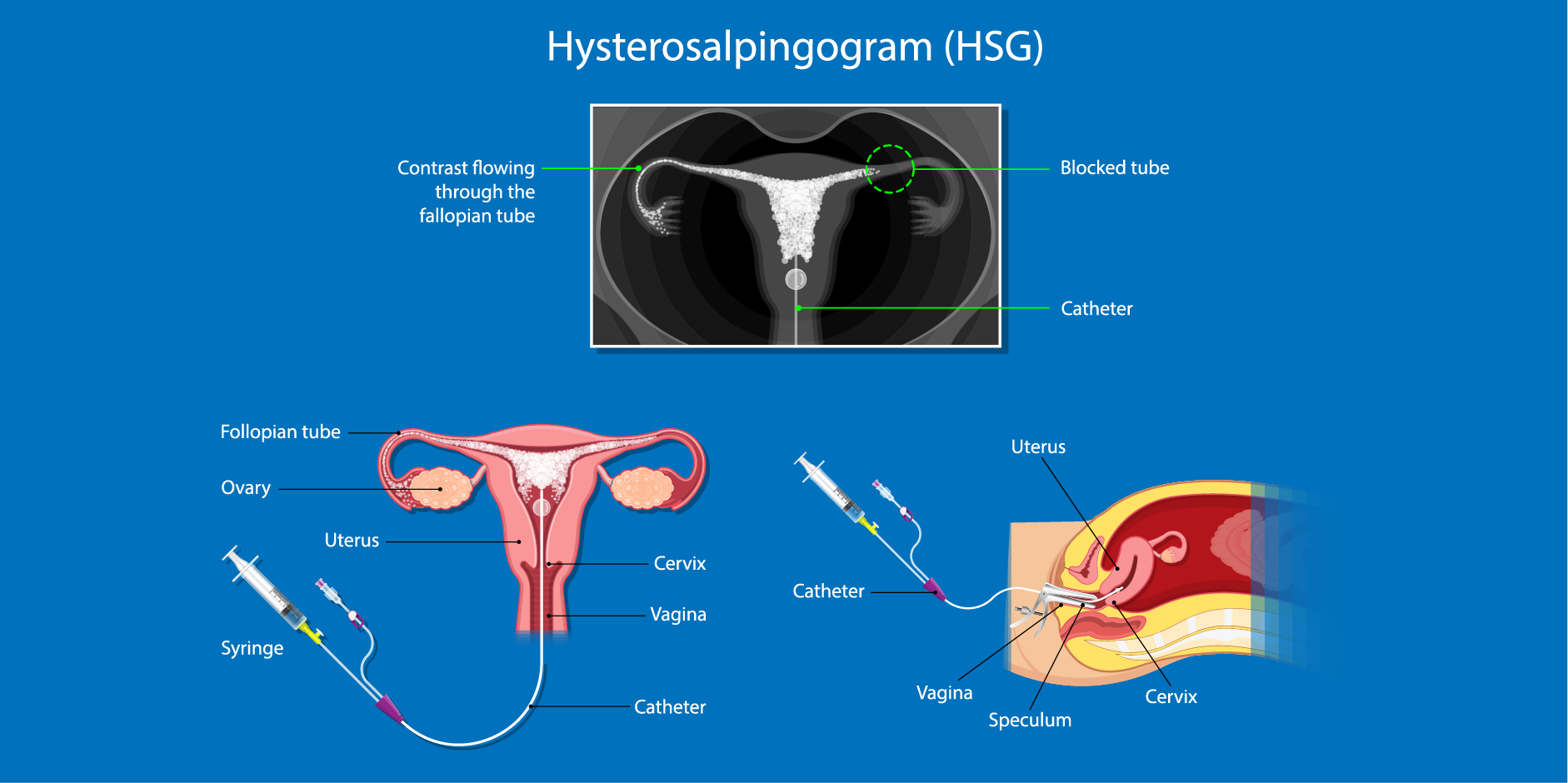 Infertility_Diagnostics 2