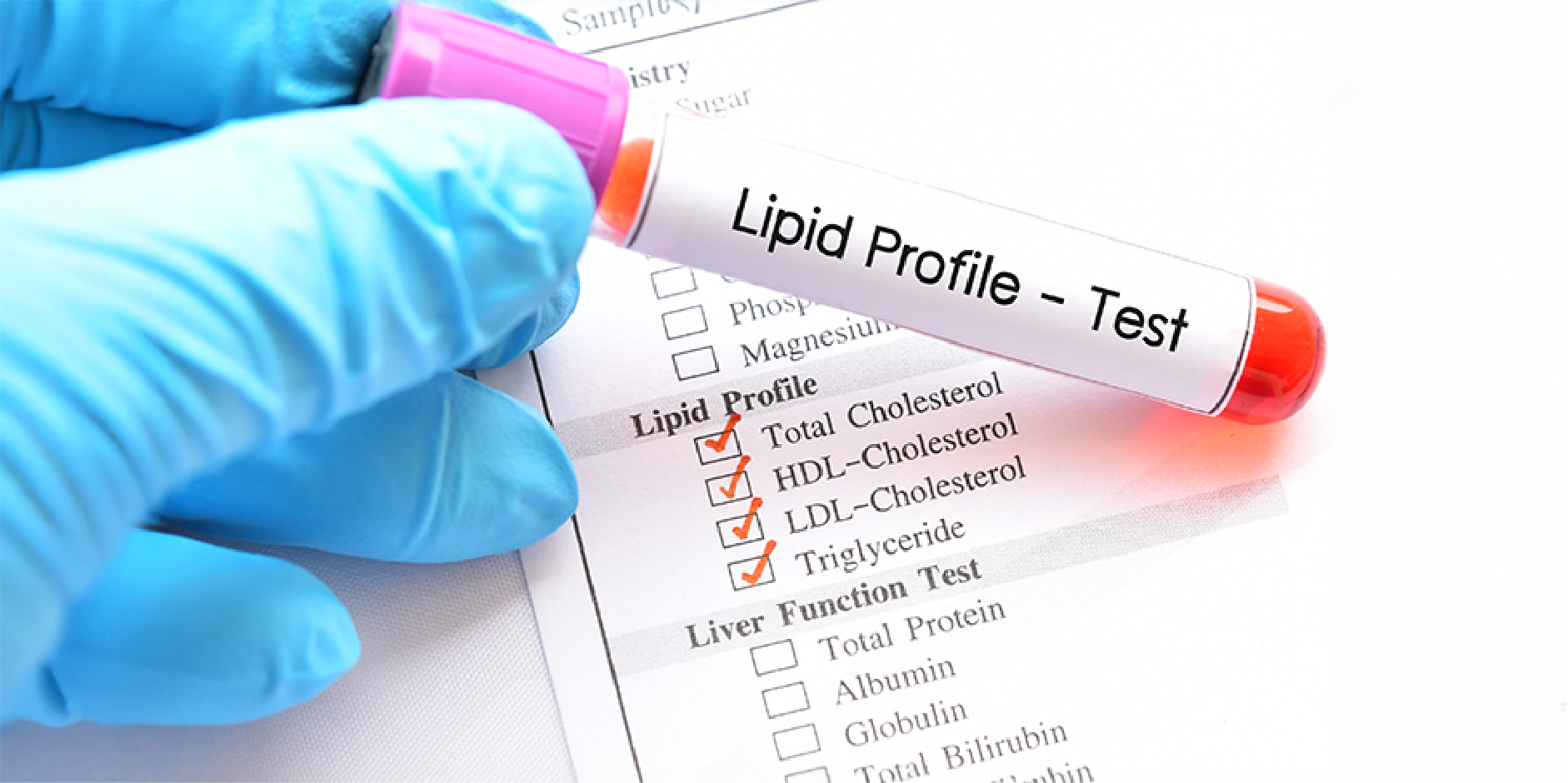 Cardiovascular Disease Prevention_Diagnostics