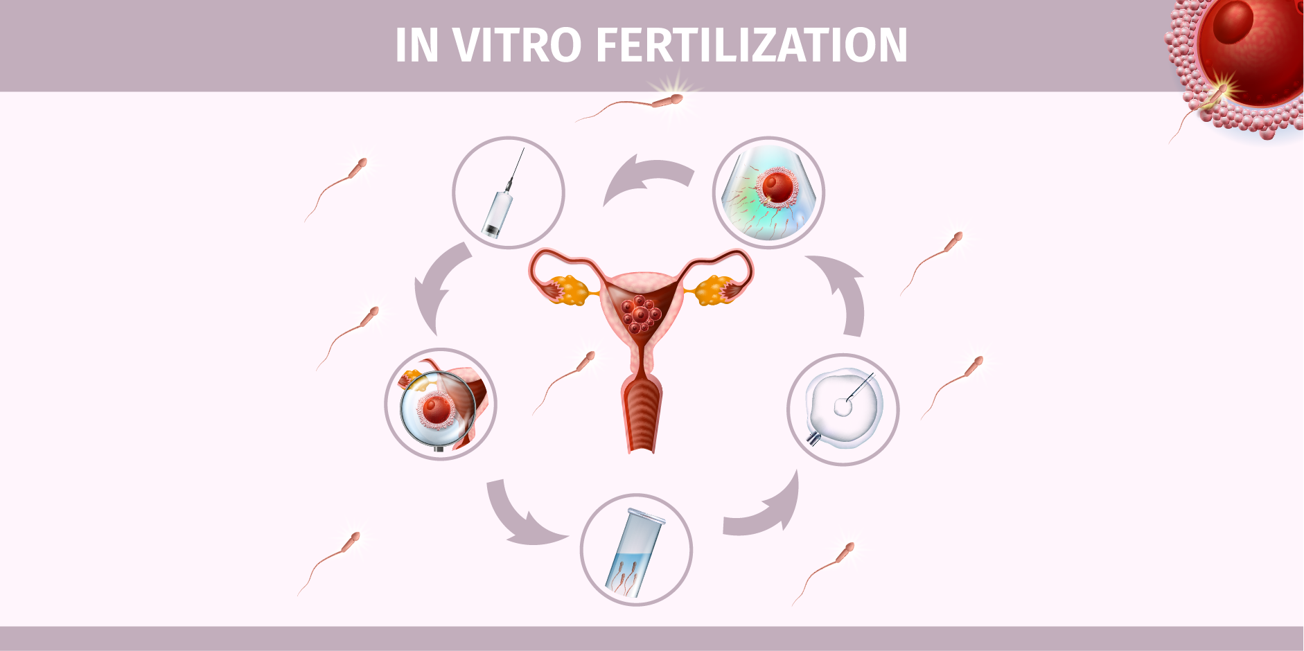 Infertility_Management 6