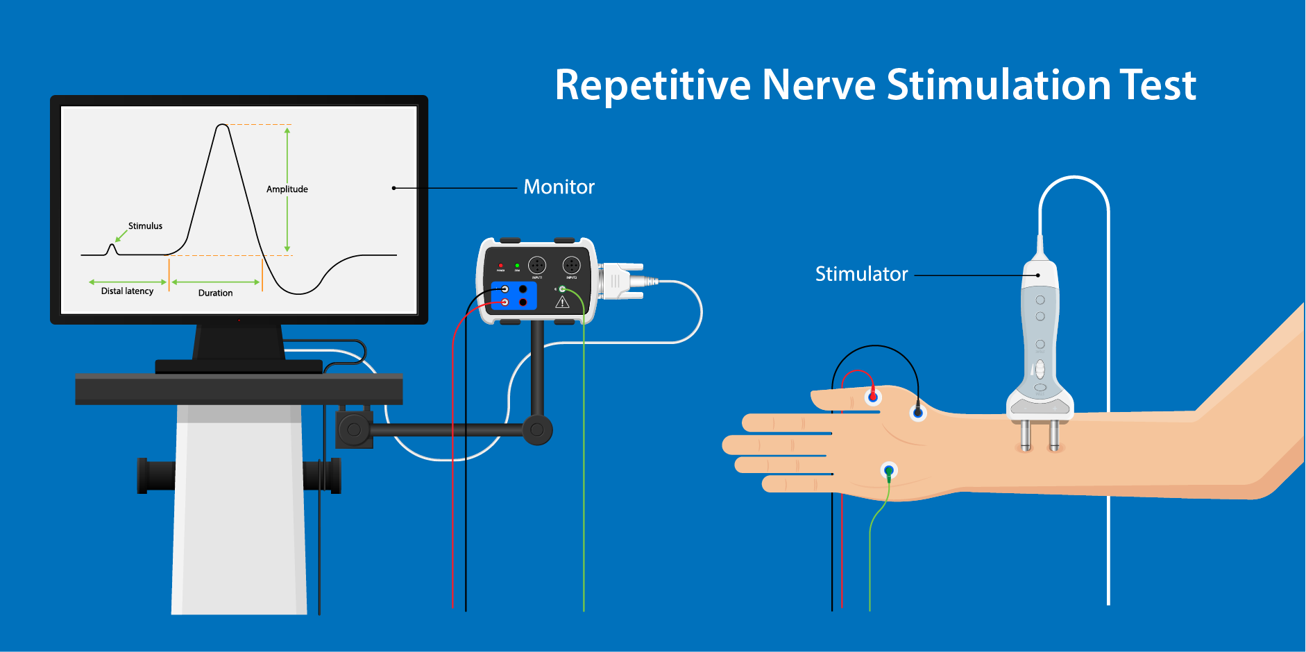 Myasthenia Gravis_Diagnostics