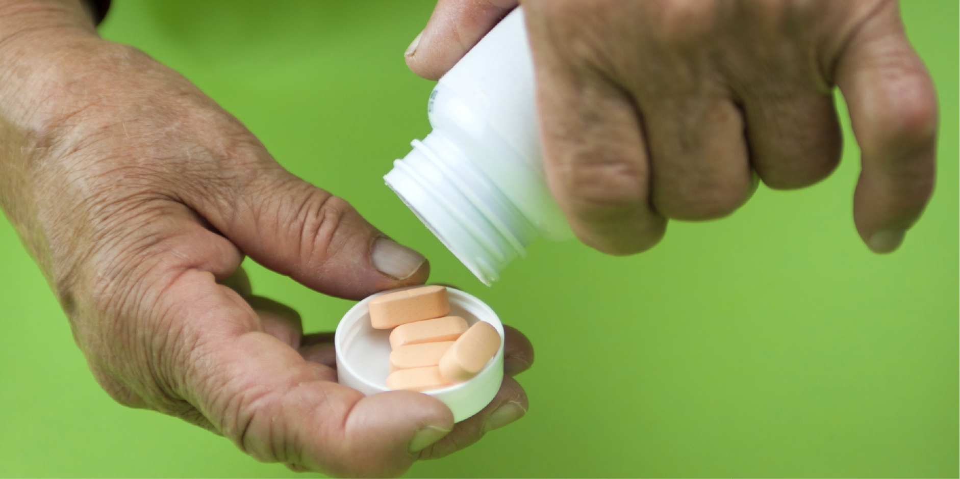 Rheumatoid Arthritis_Management 2