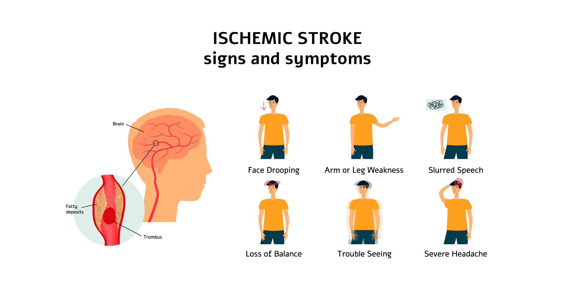 Ischemic Stroke_Initial Assesment