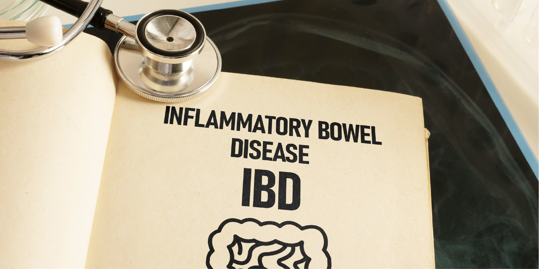 Inflammatory Bowel Disease_Disease Summary