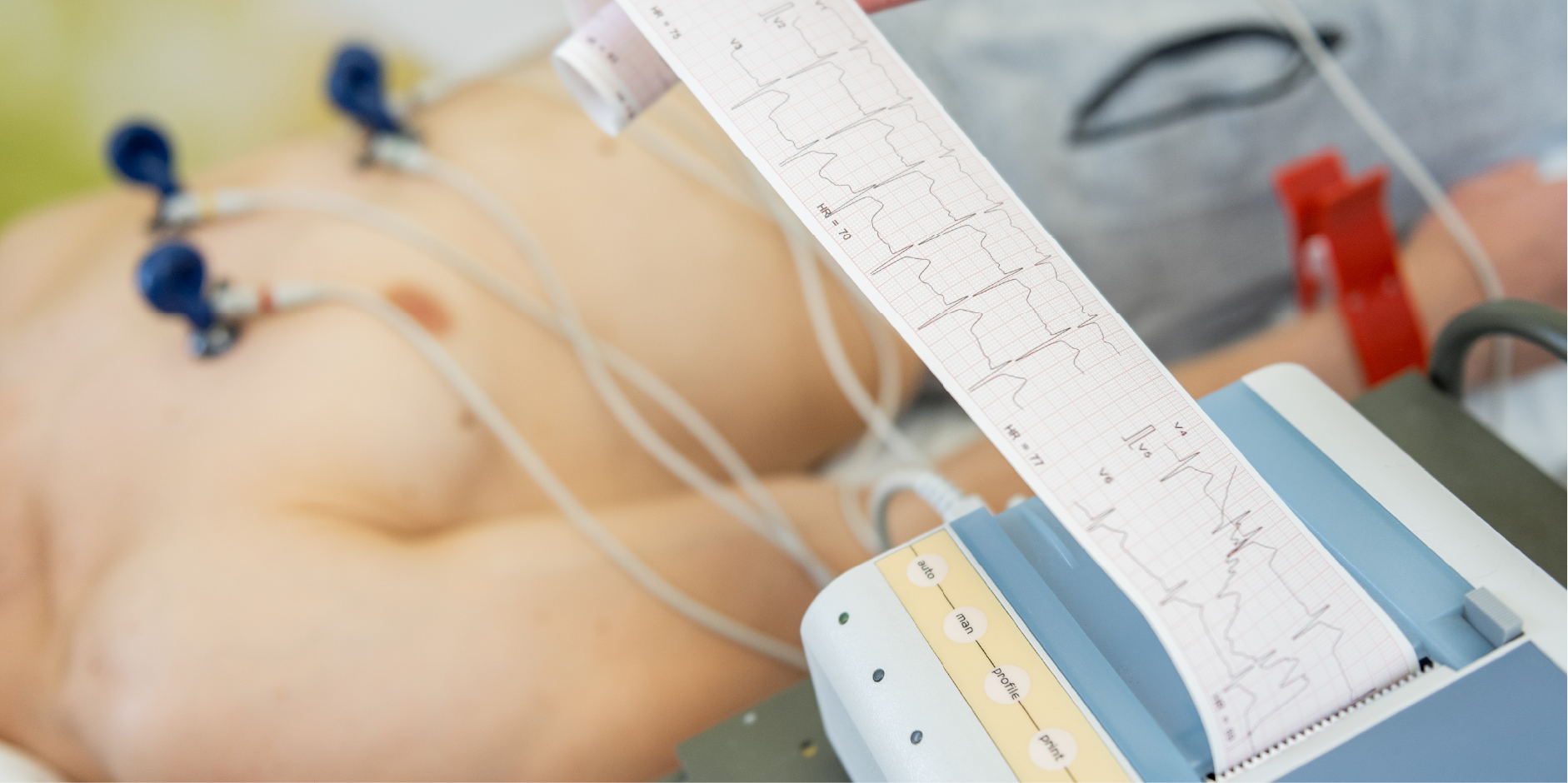 Heart Failure - Acute_Diagnostics 2