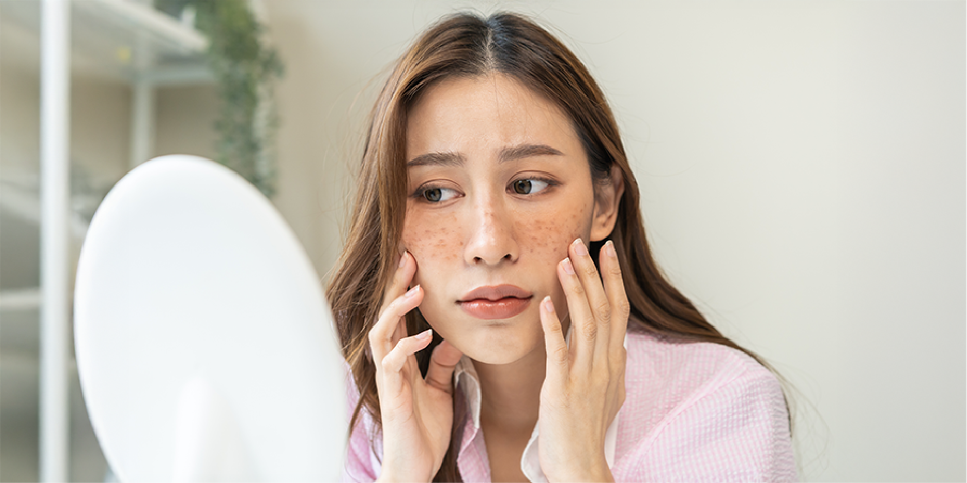 Melasma_Disease Summary