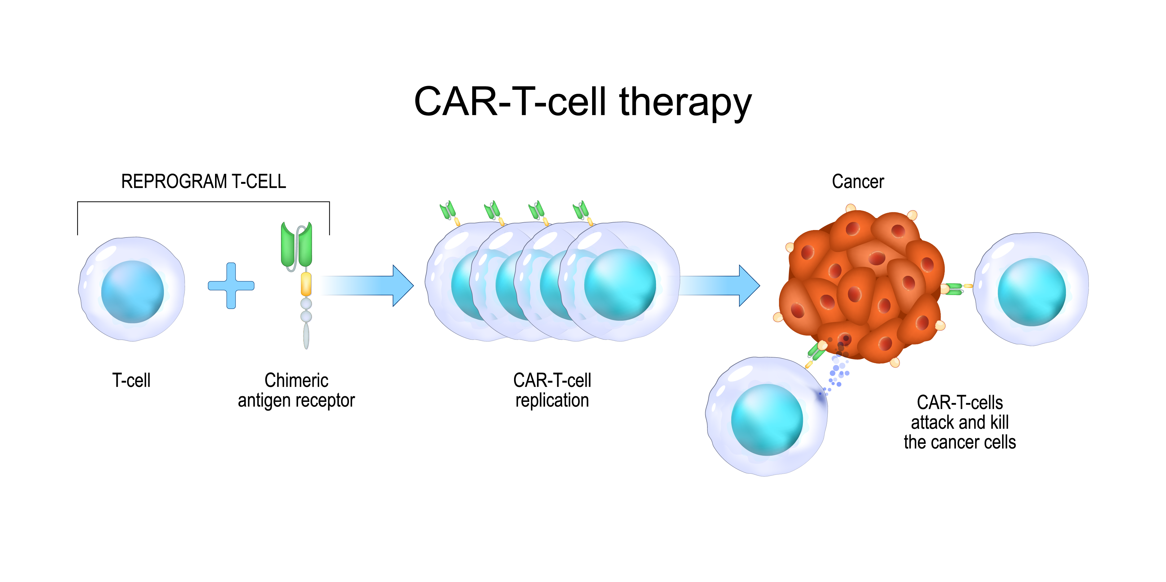 Multiple Myeloma_Management