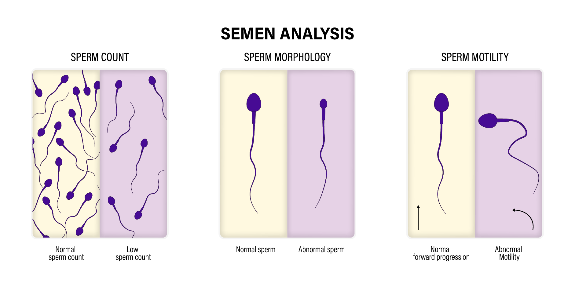 Infertility_Diagnostics 1