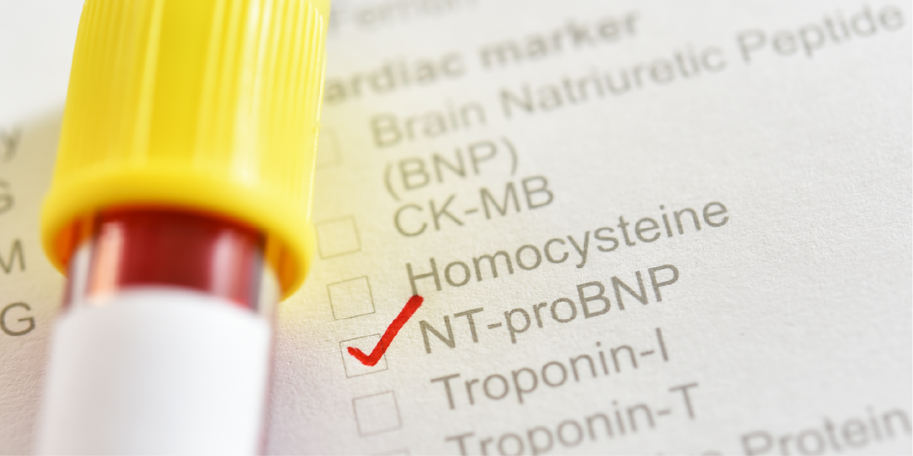 Heart Failure - Acute_Diagnostics 1