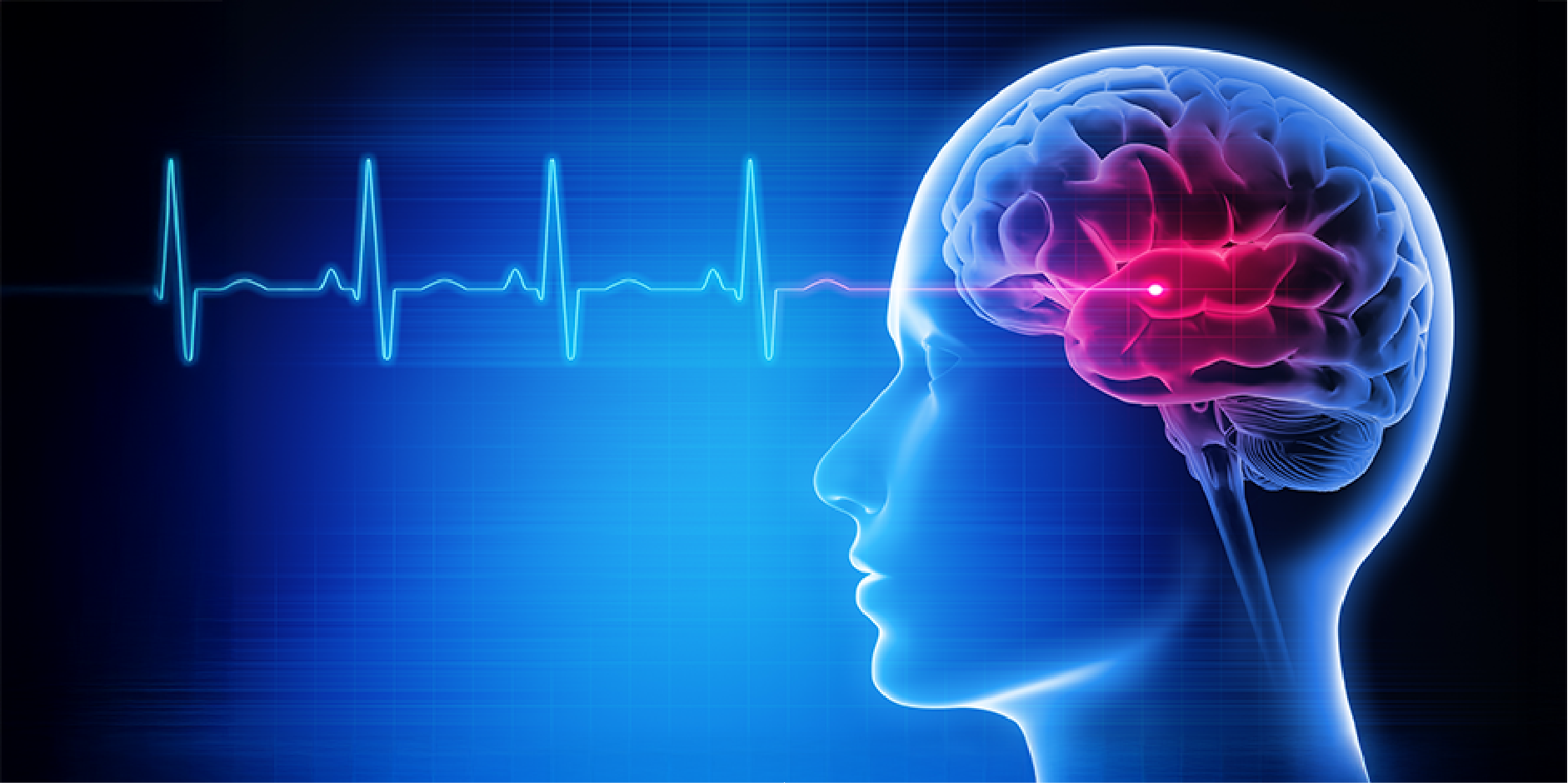 Ischemic Stroke_Disease Summary