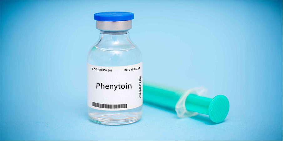 Epilepsy_Management 3